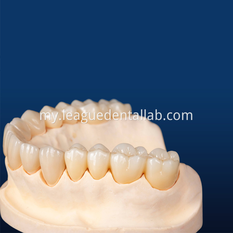 Zirconia all-ceramic teeth